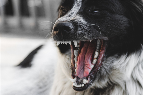 禁养的烈性犬伤人谁之过 最高法明确：犬主人无条件全责